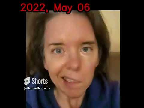Recovery After Facial Reanimation Surgery: A Time Lapse Video