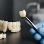 Zirconia Dental Prosthetics: 2025’s Breakout Tech & Market Shifts Reveal Surprising Winners